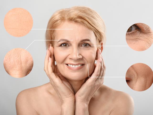 Woman with aging skin