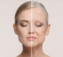 Hormonal Skin Changes in Aging Women